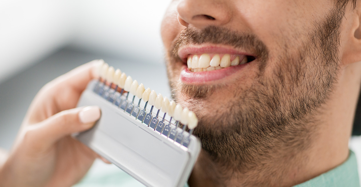 Schöne Zähne in Oberviechtach: Bleaching, Veneers u.v.m.